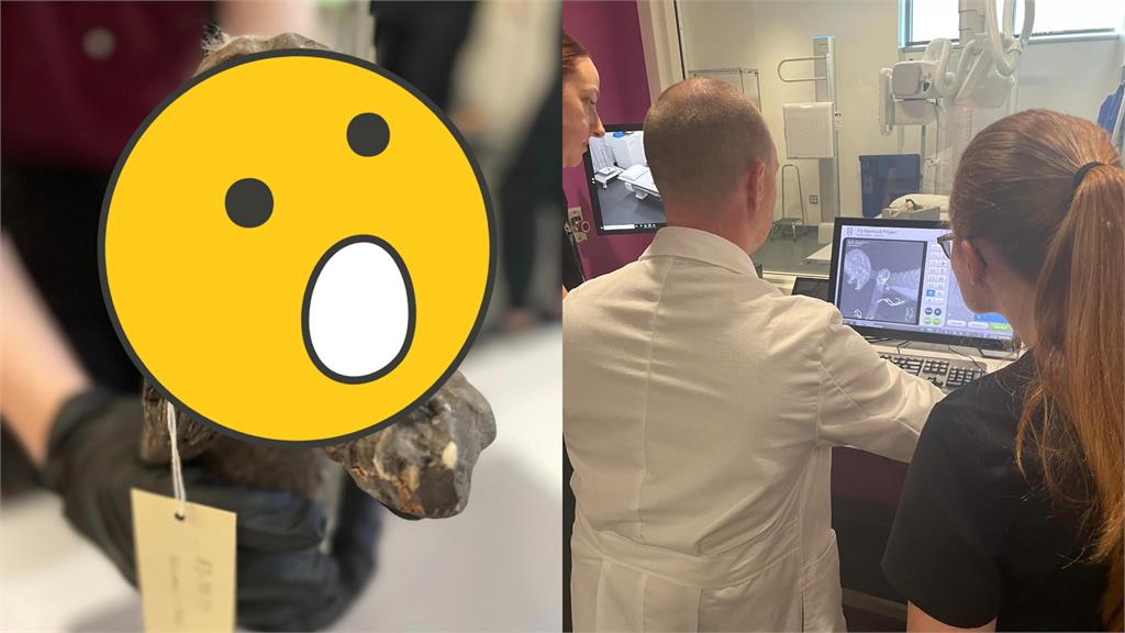 百年「美人魚木乃伊」長相曝光!專家揭最新研究