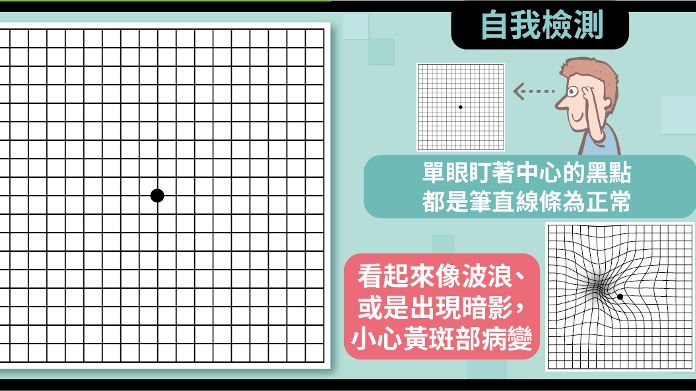 你有黃斑部病變?看這張圖1秒自我檢查