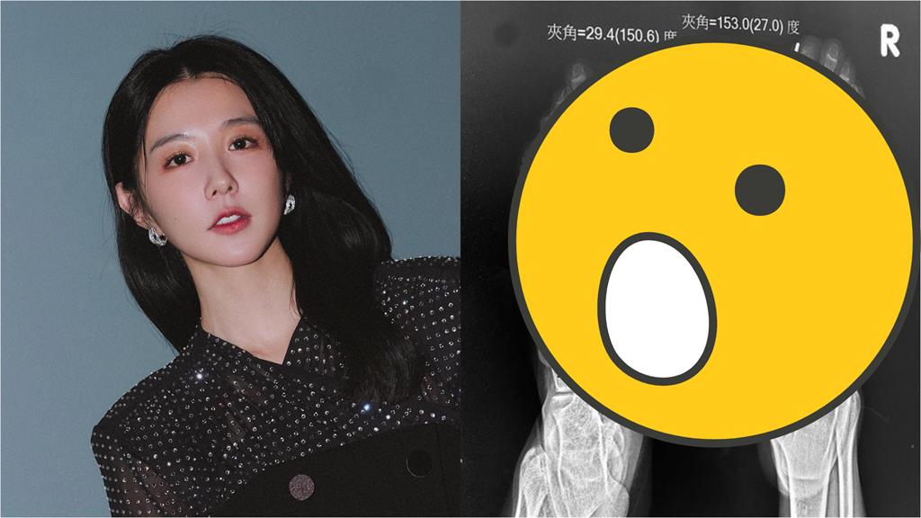 邵雨薇萬聖節曬照「1部位」全看光!網一看傻了