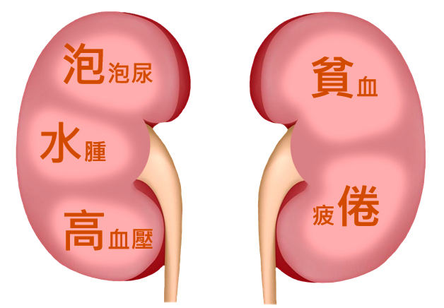 「控糖保腎3訣竅」有助擺脫腎臟病 ! 「控糖保腎3訣竅」有助擺脫腎臟病 !