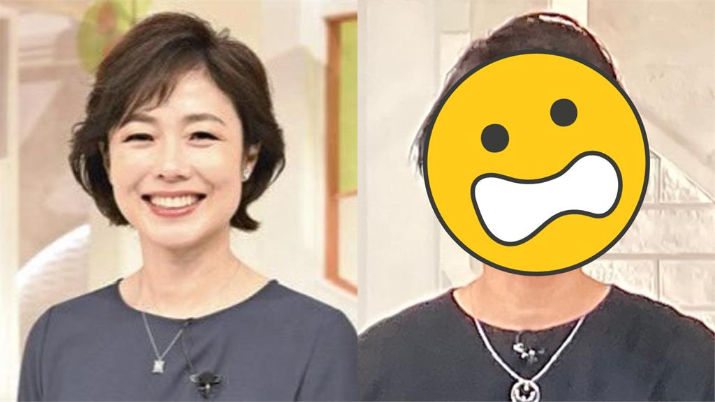 美女主播喝爛醉「慘摔下樓梯」!帶傷上節目:尾牙要小心