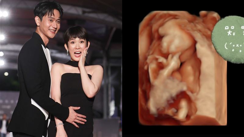 孫可芳被警告吃太多 胎兒一聽反應如影帝