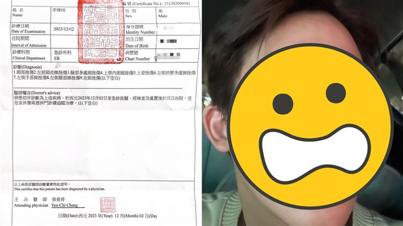 偶像劇男星街頭遭毒打 腫成豬頭傷勢曝光