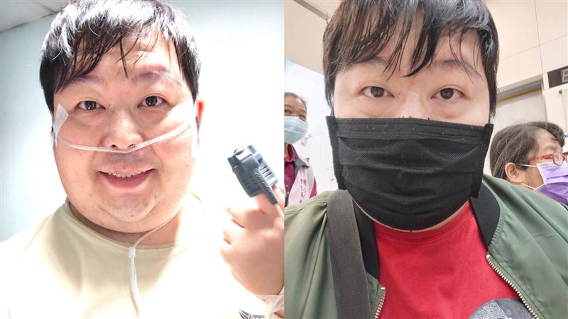 山豬打呼釀9病症纏身 「3現象」不可輕忽