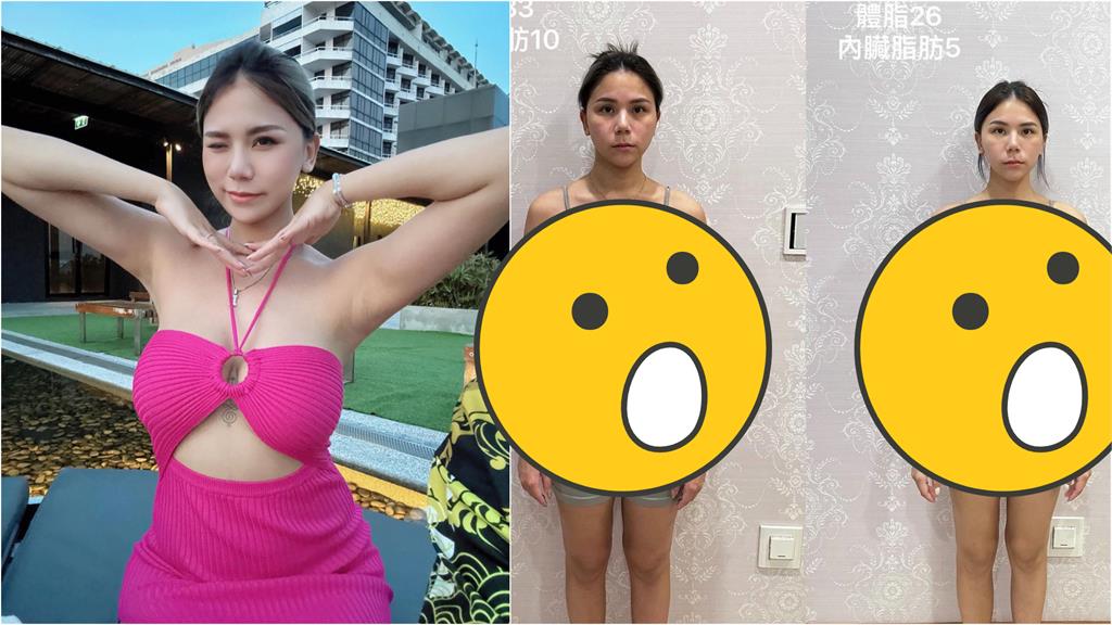 蕾菈染毒1個月暴瘦8公斤!最新近照「體態大消風」