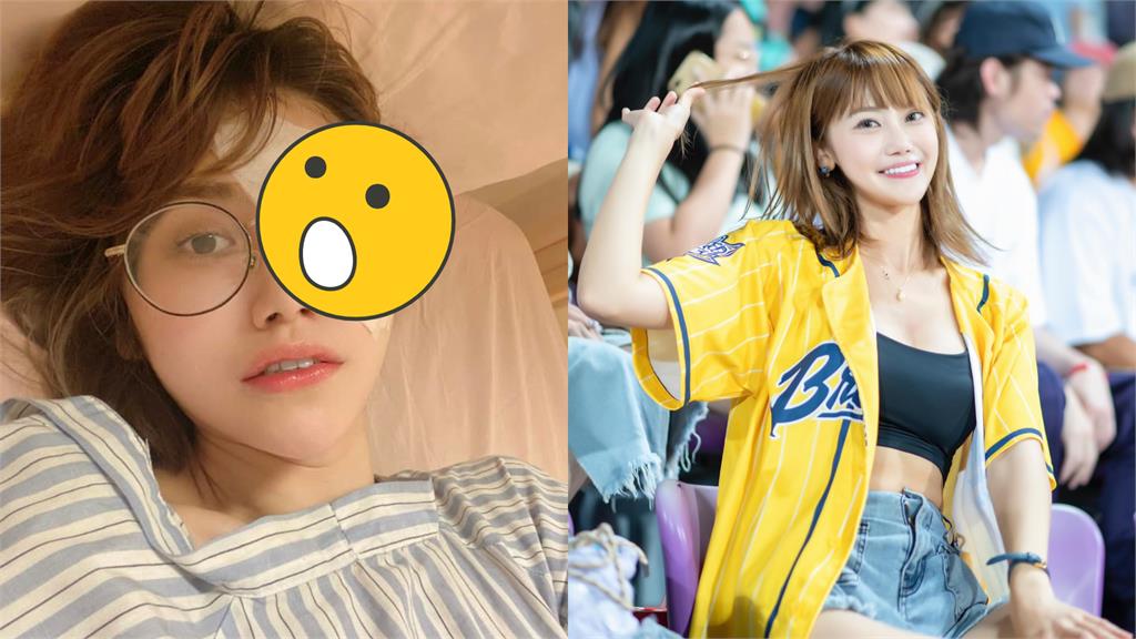 右眼近乎失明!啦啦隊女神2度手術竟患「這症狀」她險崩潰