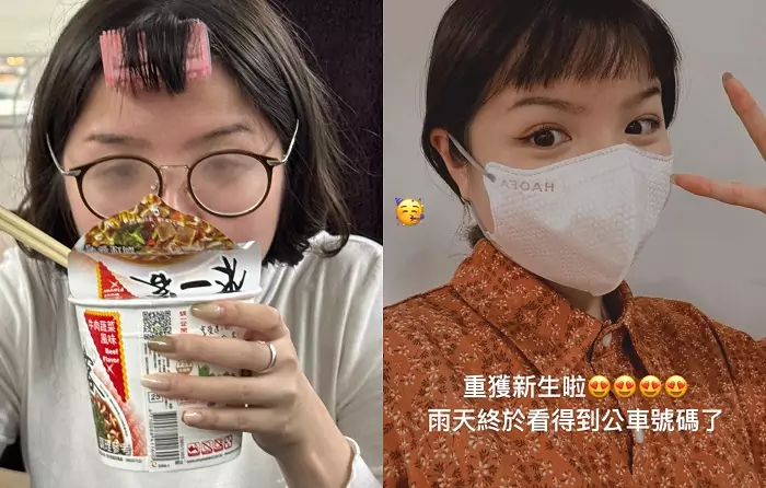 女網友分享近視雷射露「這部位」 網紛喊:好漂亮! 女網友分享近視雷射露「這部位」 網紛喊:好漂亮!