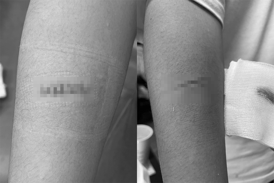 台南國中生帶彈簧刀入校劃傷同學 稱「只是好奇」竟拿同學手當實驗