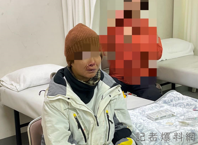 台女赴日滑雪遭港女撞「鼻噴血破相縫7針」 港女竟和男友落跑