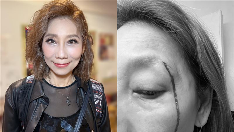 郎祖筠濺血喊:看見肉了 縫11針慘況曝光