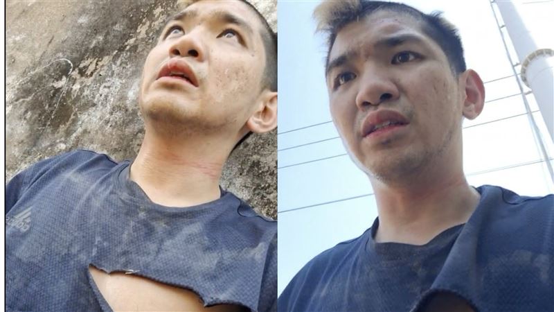 晚安小雞現身了!脖有勒痕全身發抖