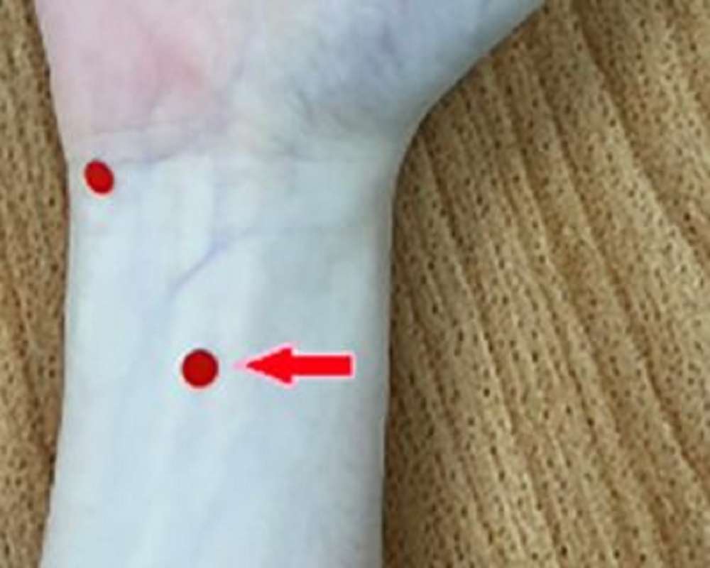 過年大吃大喝消化不良 中醫教你這樣改善