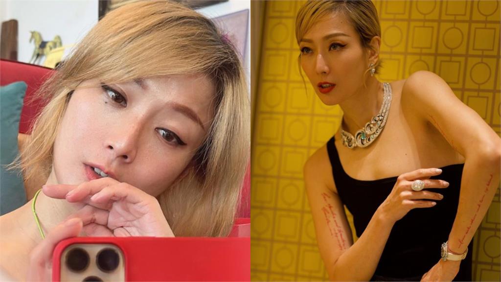 鄭秀文誤用清潔劑洗眼!目珠暴痛炸血絲…「緊急2處置」她崩潰了