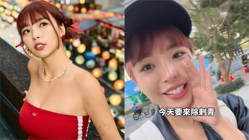 阿圓雷射除刺青「痛到臉歪」!遭酸「何必當初?」不忍反擊了