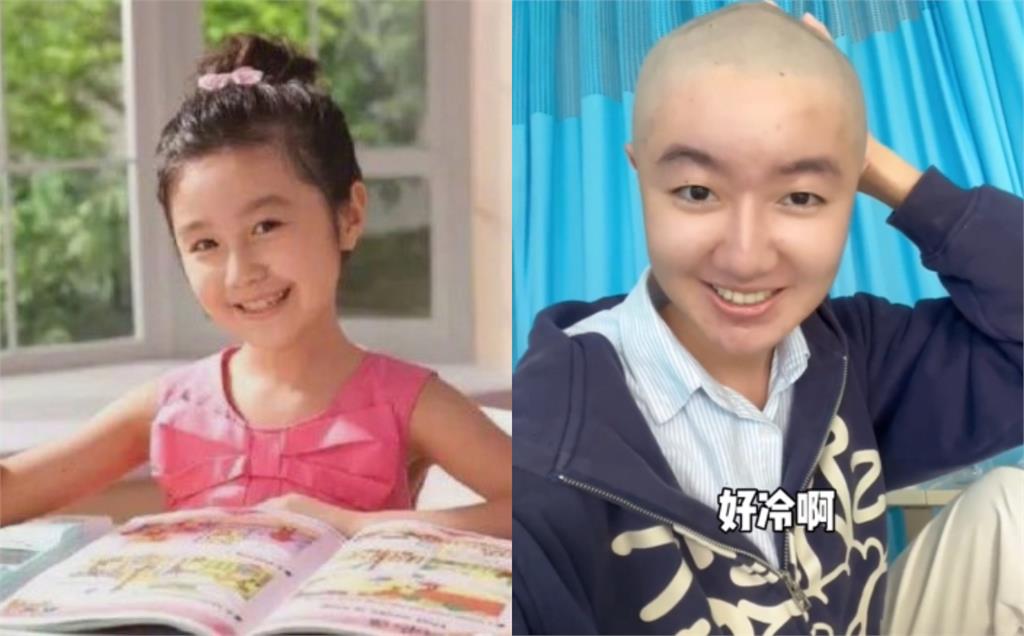 「最紅童星」罹罕見腦瘤!動刀開顱12小時…進ICU病況曝