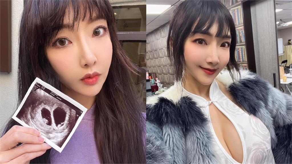 39歲資生堂千金準備當5寶媽 曬「雙胞胎孕肚」曝魔鬼身材