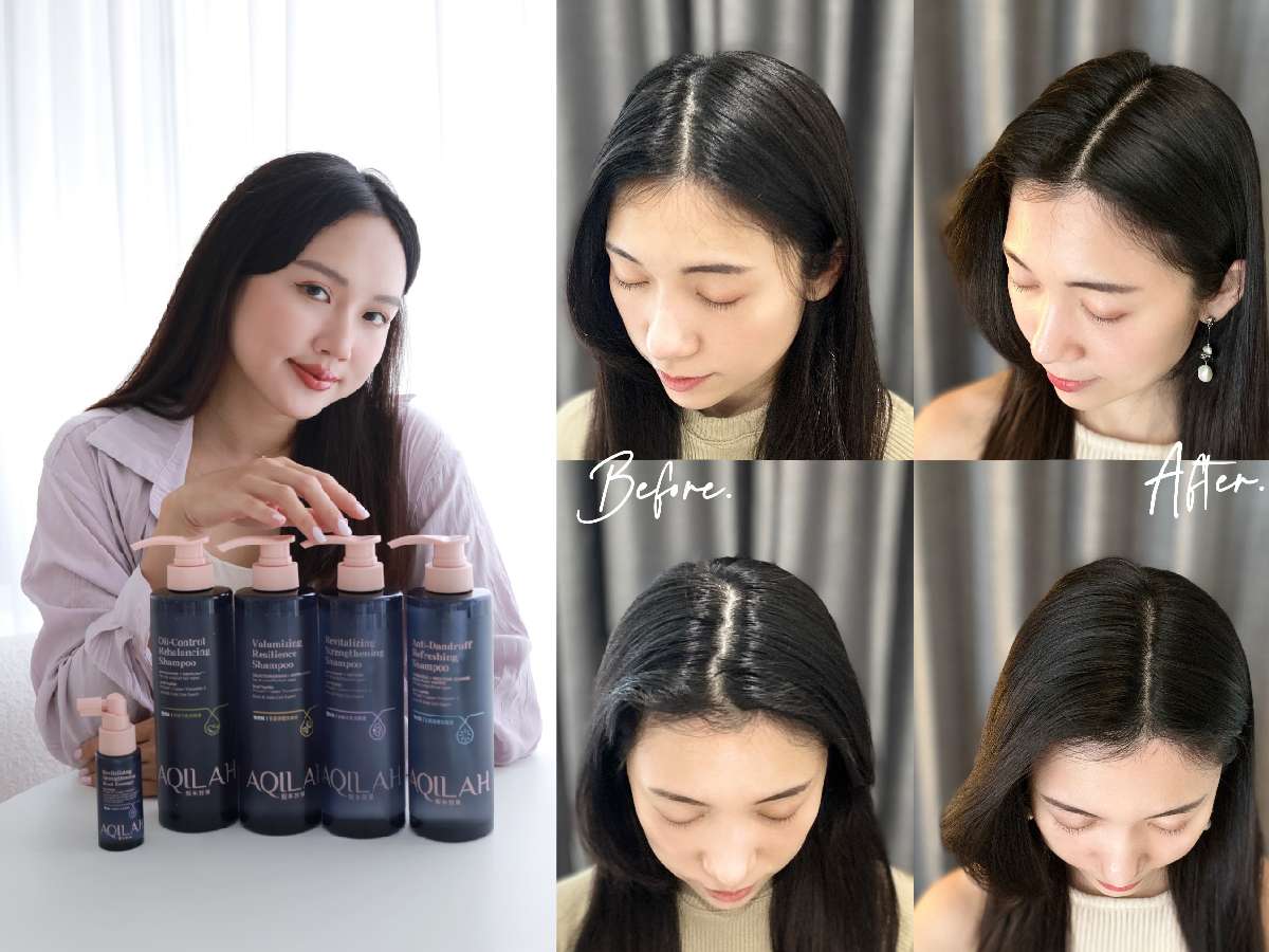 4週髮根強韌豐厚!專業醫學美容醫師推薦 科研健髮品牌AQILAH髮本對策 屈臣氏熱銷賣爆 20240523 Aqilah髮本對策 廣編 聯播網圖2