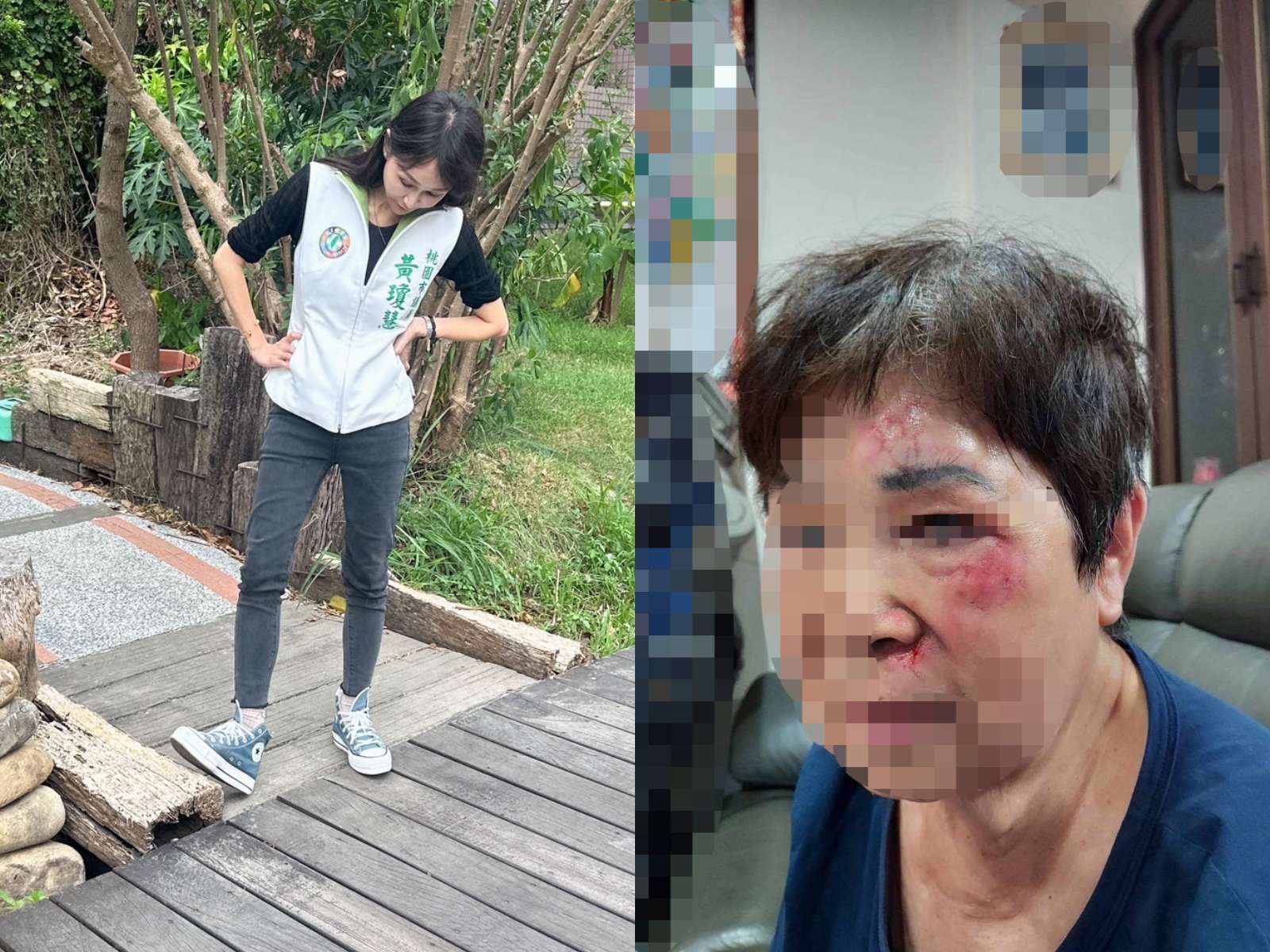 長輩桃林步道慘跌鼻青臉腫 黃瓊慧曝:多處木棧板已翹起