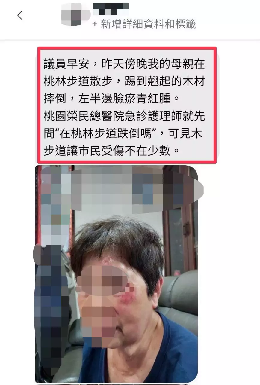 長輩桃林步道慘跌鼻青臉腫 黃瓊慧曝:多處木棧板已翹起 S 358547512 0
