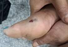 女子上山工作遭毒蛇咬傷 桃消迴龍分隊緊急救援