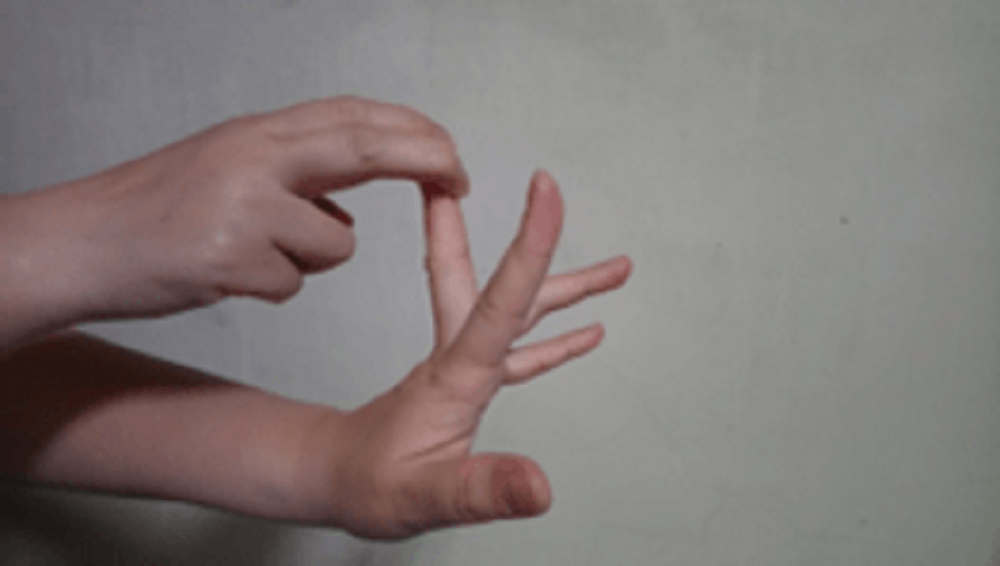 手麻、無力腕隧道症候群作祟!北榮桃分院:這樣做緩解不適