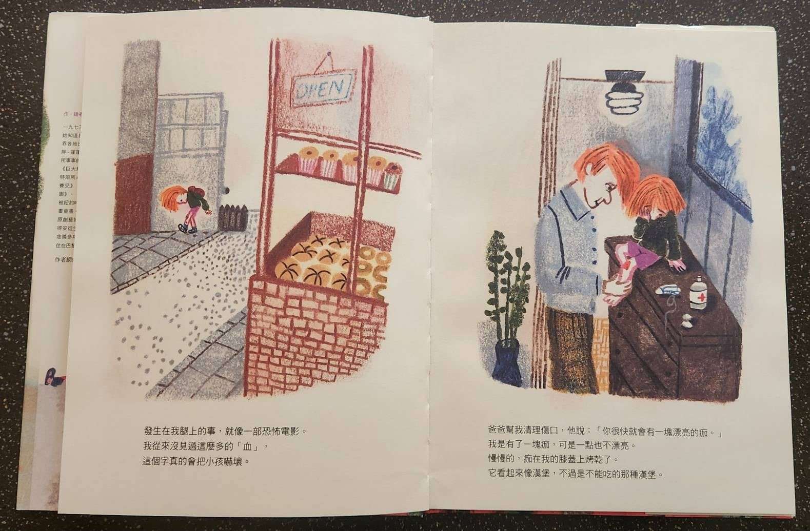 副刊/每道傷疤都是我的曾經 1101副刊圖二 0