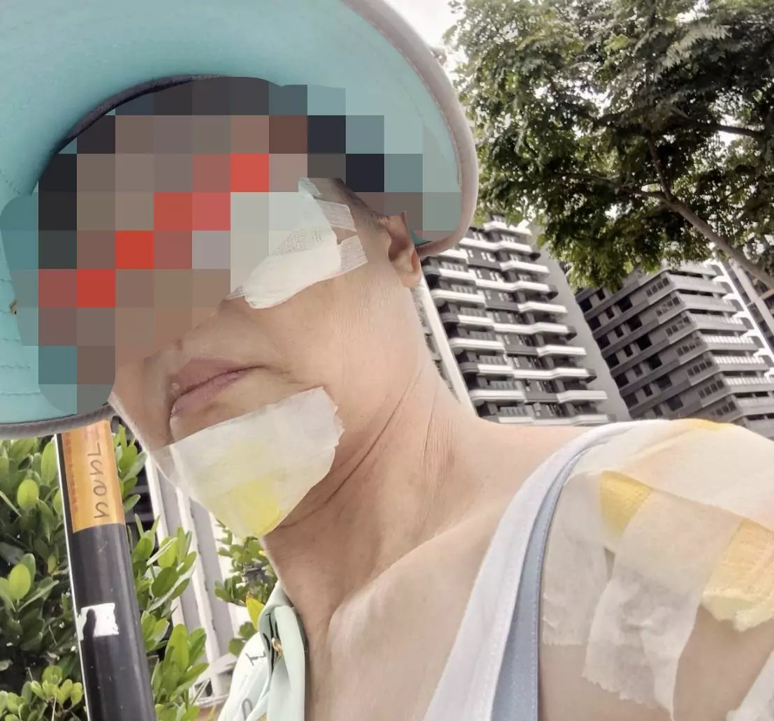 桃園文化局說明婦人摔傷事件 持續協調理賠積極處理 桃園文化局說明婦人摔傷事件 持續協調理賠積極處理