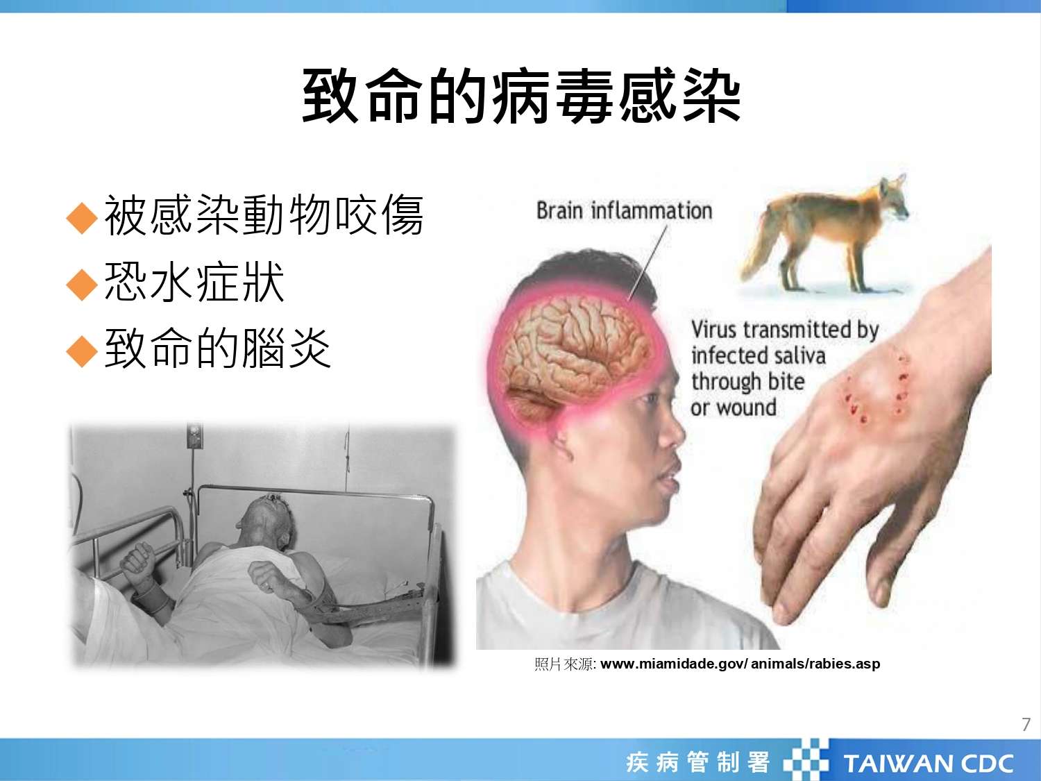 預防致命狂犬病 北榮桃園分院建議這樣做 966574