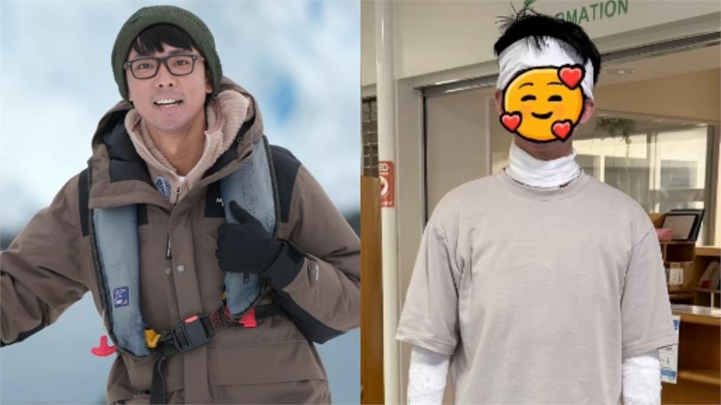 3度赴日這醫院治異膚 阿滴盼幫助其他病友