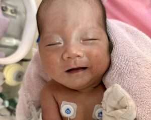 因早產出生僅1千公克！聖保祿醫院暖心守護助她平安成長