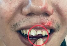 桃園大廟前纜線外露變陷阱!男慘摔斷門牙腦震盪