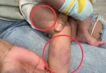 桃園八德驚傳保母虐嬰!婦幼局:已依規定廢證 桃園八德驚傳保母虐嬰!婦幼局:已依規定廢證