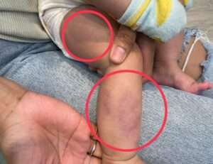 桃園八德驚傳保母虐嬰!婦幼局:已依規定廢證