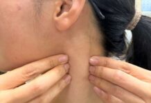 睡不好、肩頸僵硬與1文明病有關 桃園醫院:女性患者比例是男性2倍