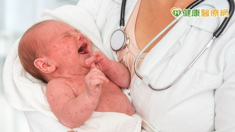 再增2例新生兒腸病毒重症！　疾管署急呼籲「有這些症狀」需警覺