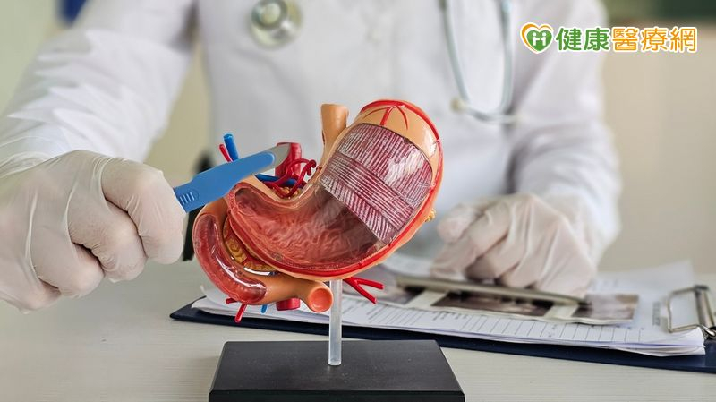 減重手術後出現嚴重貧血併發症 「二次手術修正」找回健康