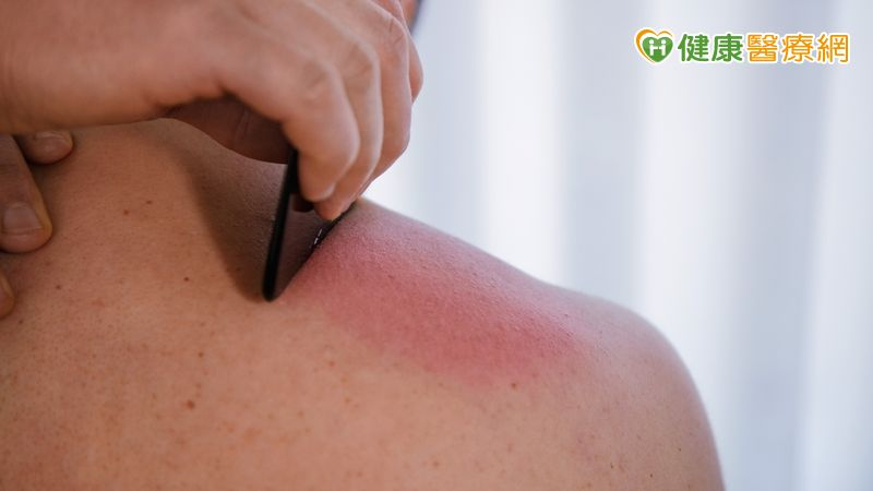 天熱吹冷氣、喝冷飲也會熱傷害! 醫:熱氣「鎖」體內