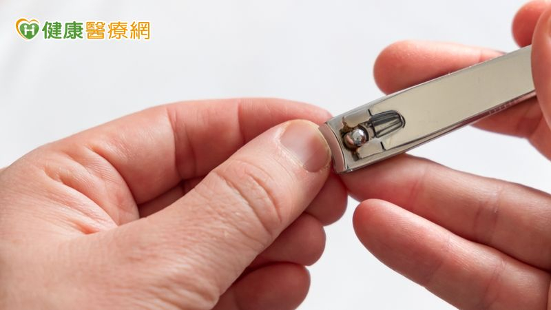 剪指甲太深惹禍 年輕女急性甲溝炎痛到跛行