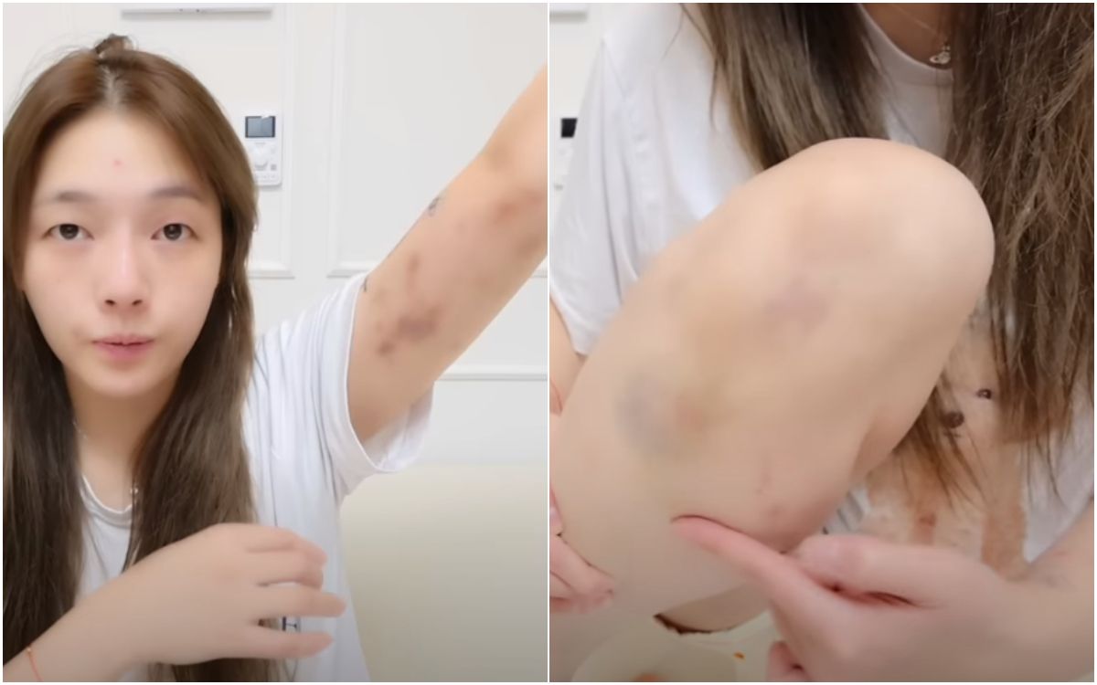 劉力穎遭韓男施暴 韓警誤認「中國人犯案」原因曝光:1天2台女遭打