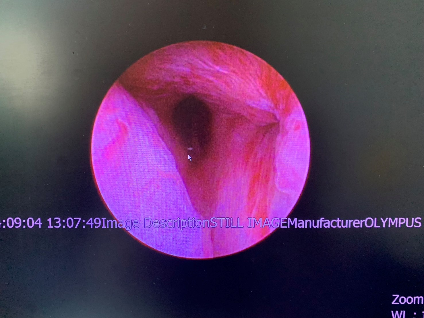 擺脫尿不乾淨困擾!北榮桃分院1招助患者恢復順暢人生 25