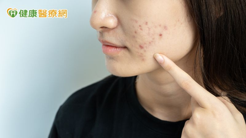 季節交替長痘怎麼辦?中醫:保養肌膚靠這三大關鍵步驟!