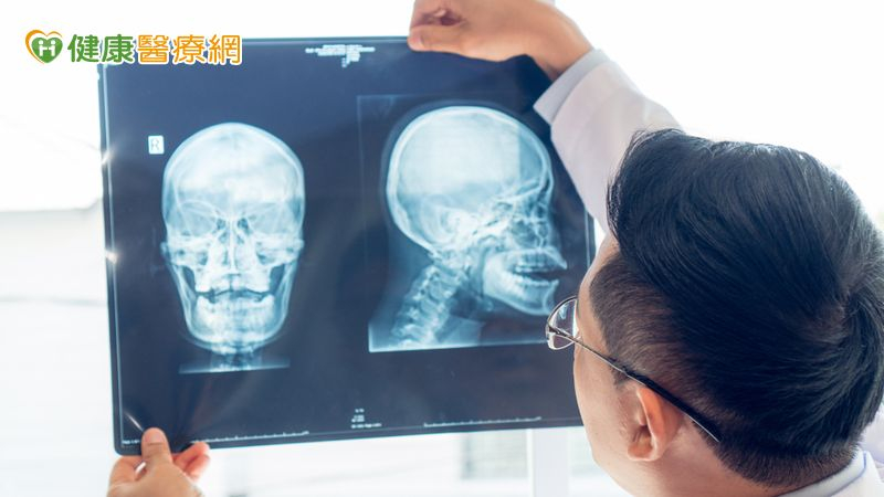 頭頸癌病人手術後還能保有自然外觀 客製化口腔顱顏技術受關注