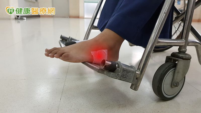 奇美醫院傷口照護中心推居家診療 攜手社區打造「無縫醫療照護網」