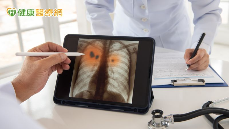 免疫藥物治療加入臨床選項 醫親曝小細胞肺癌治療未來走向