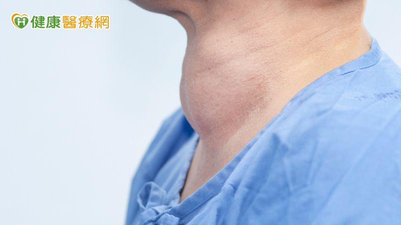 失控的甲狀腺亢進可能引發甲狀腺風暴!醫師教你如何控制甲狀腺