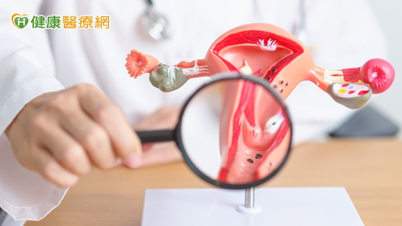 台灣迎戰「世界消除子宮頸癌日」 篩檢下修至25歲+3措施升級防護