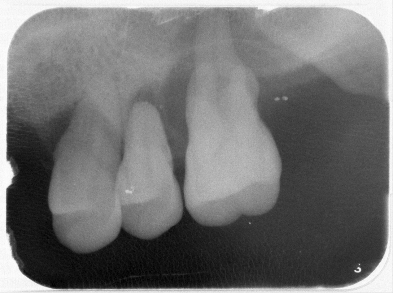 牙周炎別拖延就醫!北榮桃園分院:去除病因、定期回診很重要 54gswrfq 2