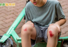 傷口癒合不是結束 預防疤痕從「這時機」開始!醫揭疤痕凝膠應用策略