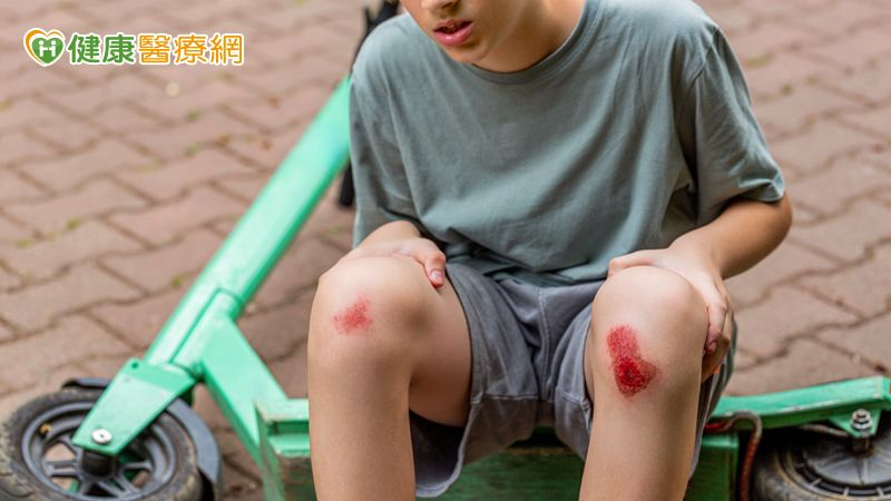 傷口癒合不是結束 預防疤痕從「這時機」開始!醫揭疤痕凝膠應用策略