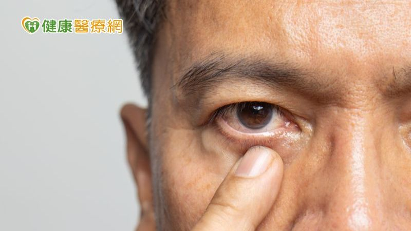 為何青光眼一定要控眼壓?醫解析「青光眼導流支架」微創手術新選擇!
